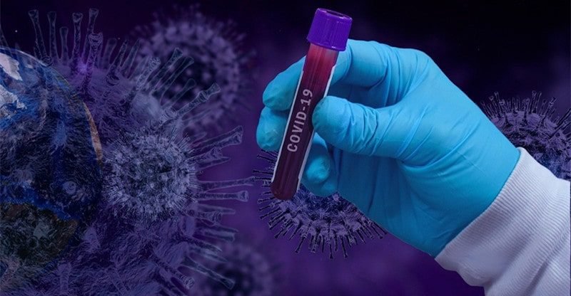 3 Issues To Know About The Price Of COVID-19 Testing And Remedy