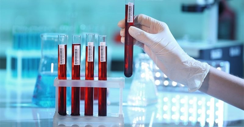 3 Ideas for Getting Bloodborne Pathogens Coaching On-line