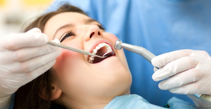 All the things You Have to Know About Snap-on Smile