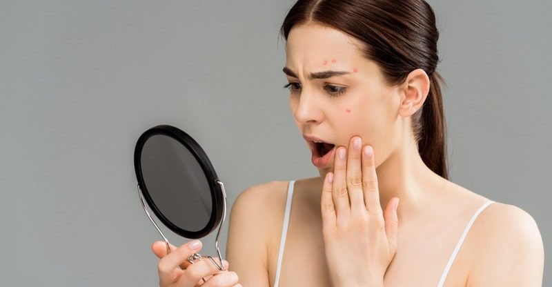 5 Causes To Take into account Probiotics For Pimples
