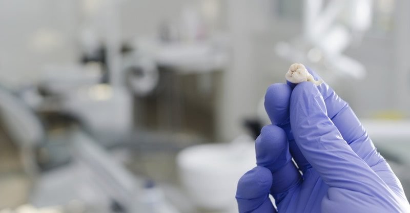 Knowledge Enamel Extraction Surgical procedure: The right way to Put together and What to Count on